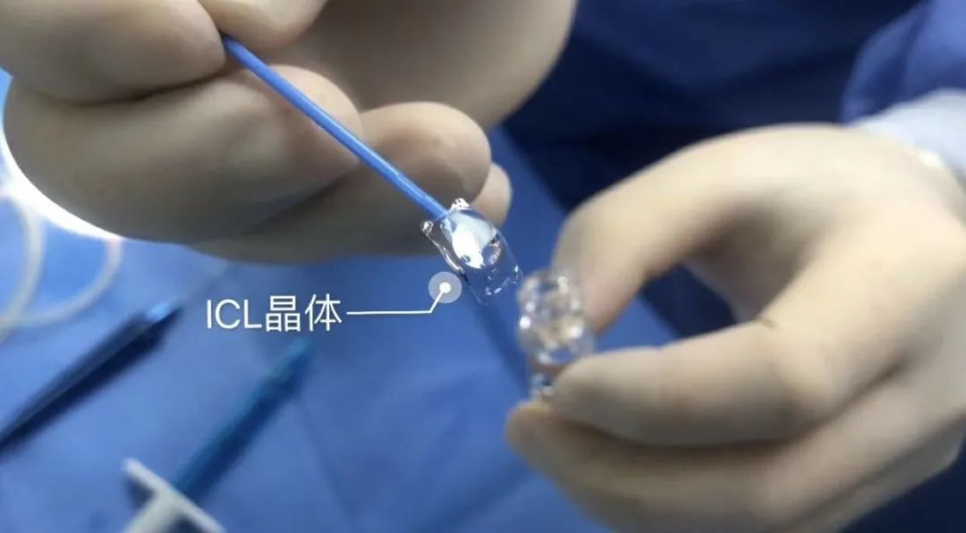 近视手术icl晶体植入贵在哪里