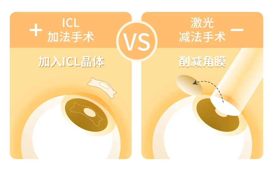 ICL手术与激光手术对比